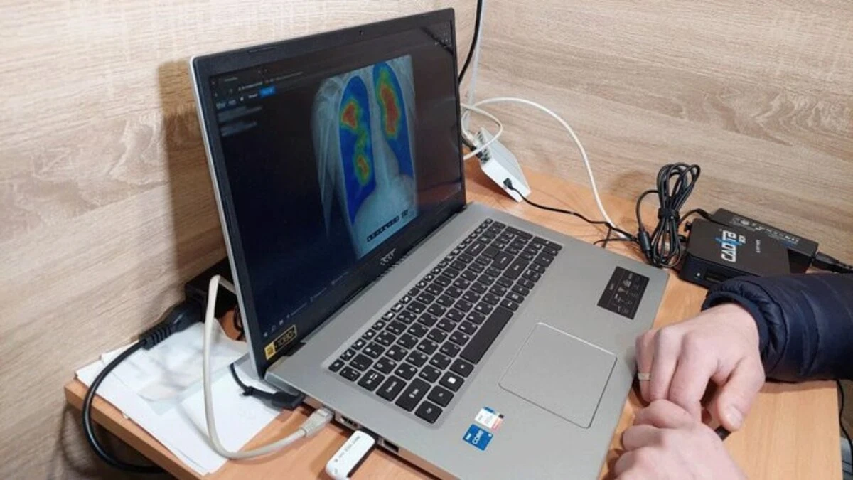 Мобільний рентген-кабінет