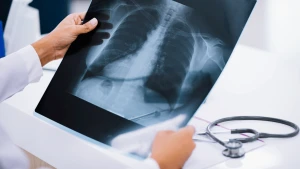 Зображення ілюстративне. Canva