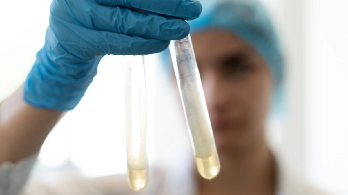 Проведення дослідження